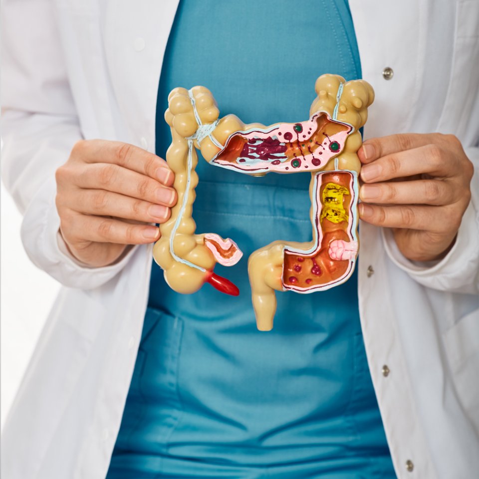 How is Appendix Surgery Performed?