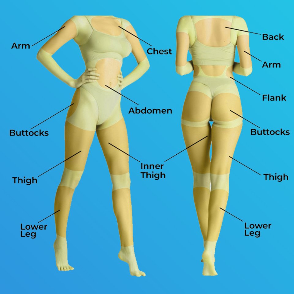 Liposuction Areas Diagram
