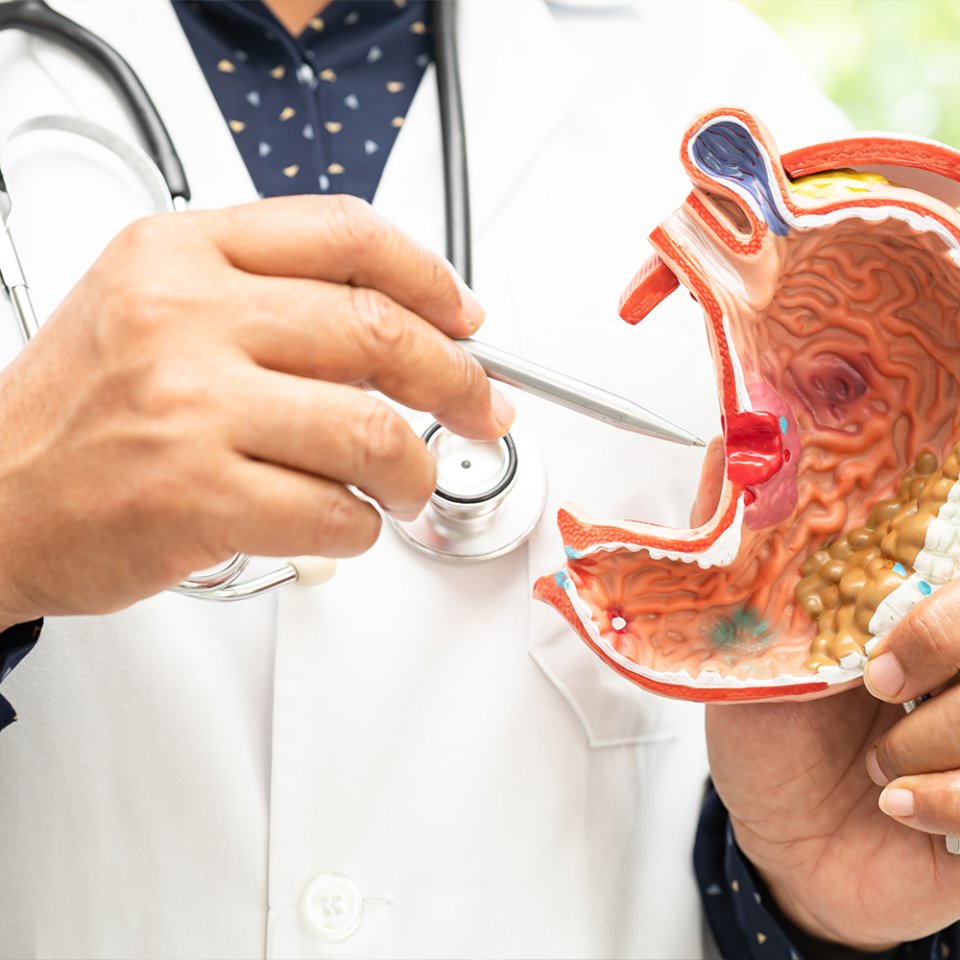 Why is Stomach Surgery Needed?