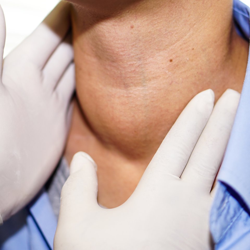 How is Esophageal Surgery Performed?