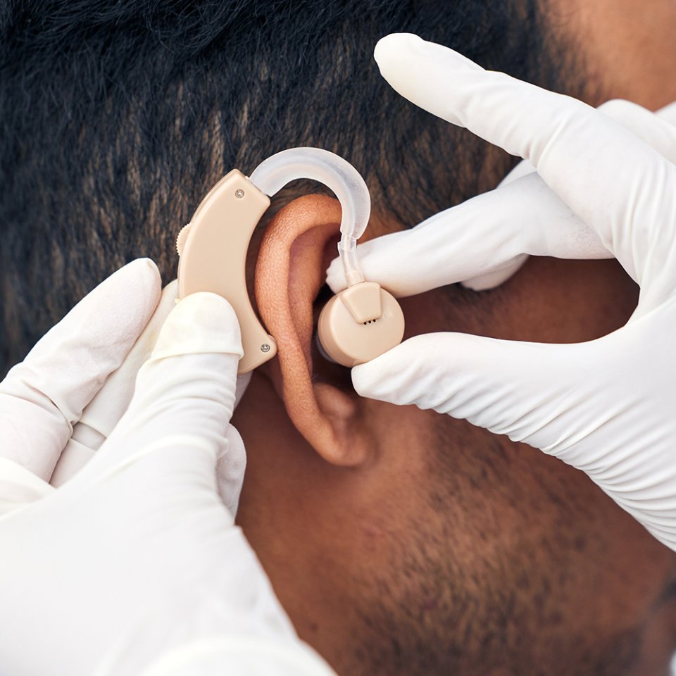 Who Is a Good Candidate for Cochlear Implant Surgery?