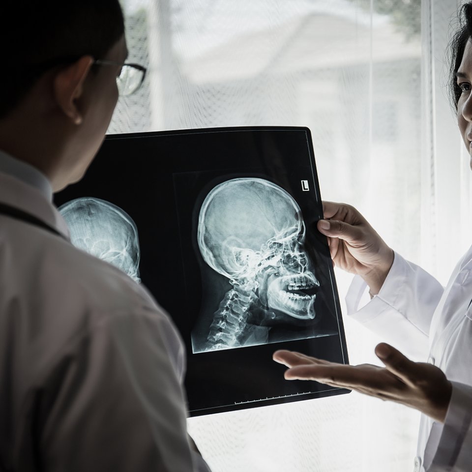 Who Is a Good Candidate for Head & Neck Tumor Surgery?