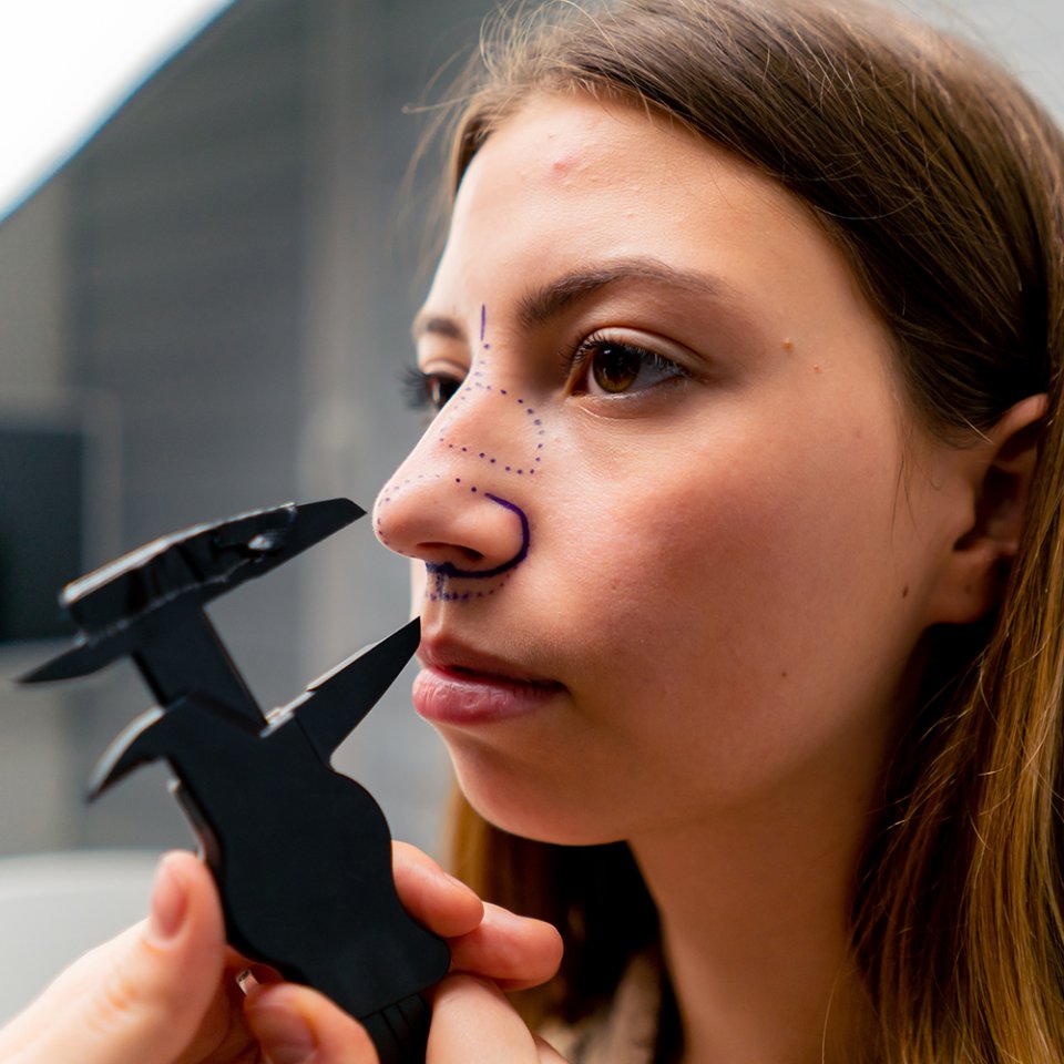 Who Is a Good Candidate for Septoplasty?