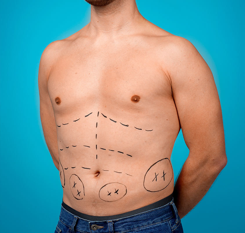 Post-Surgery Discomforts