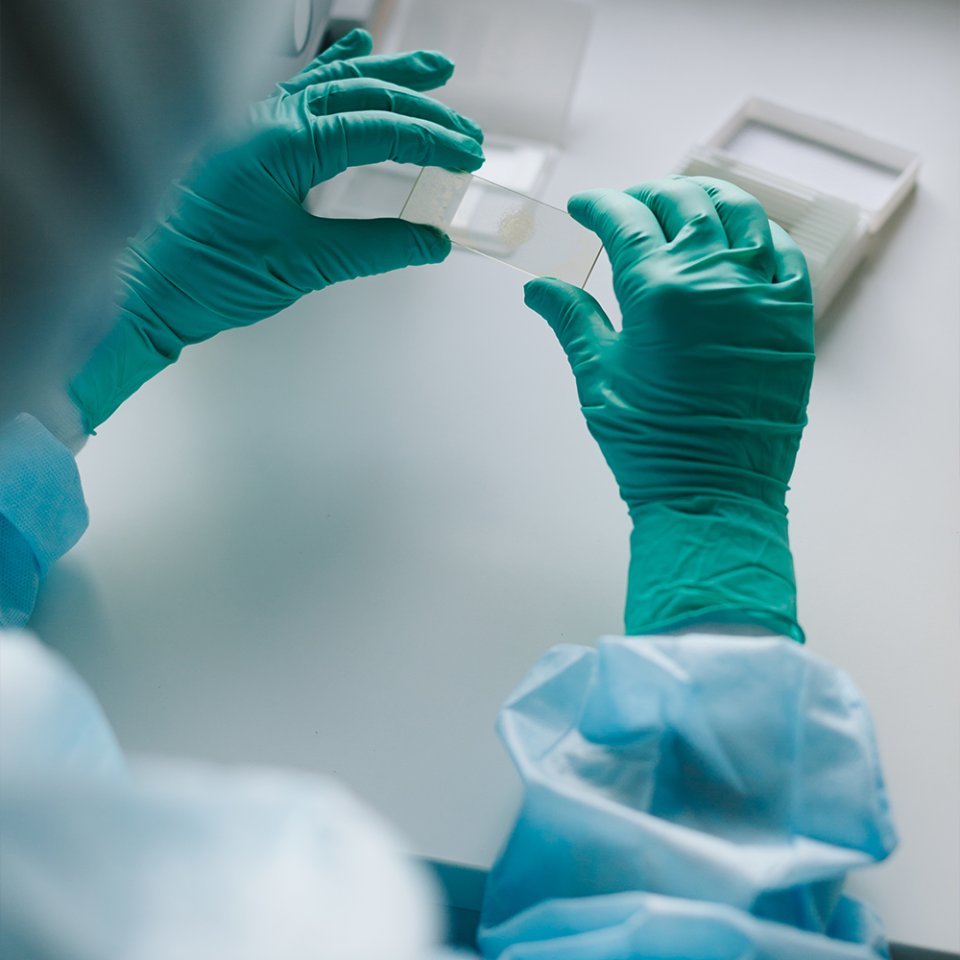 How is CRS Performed?