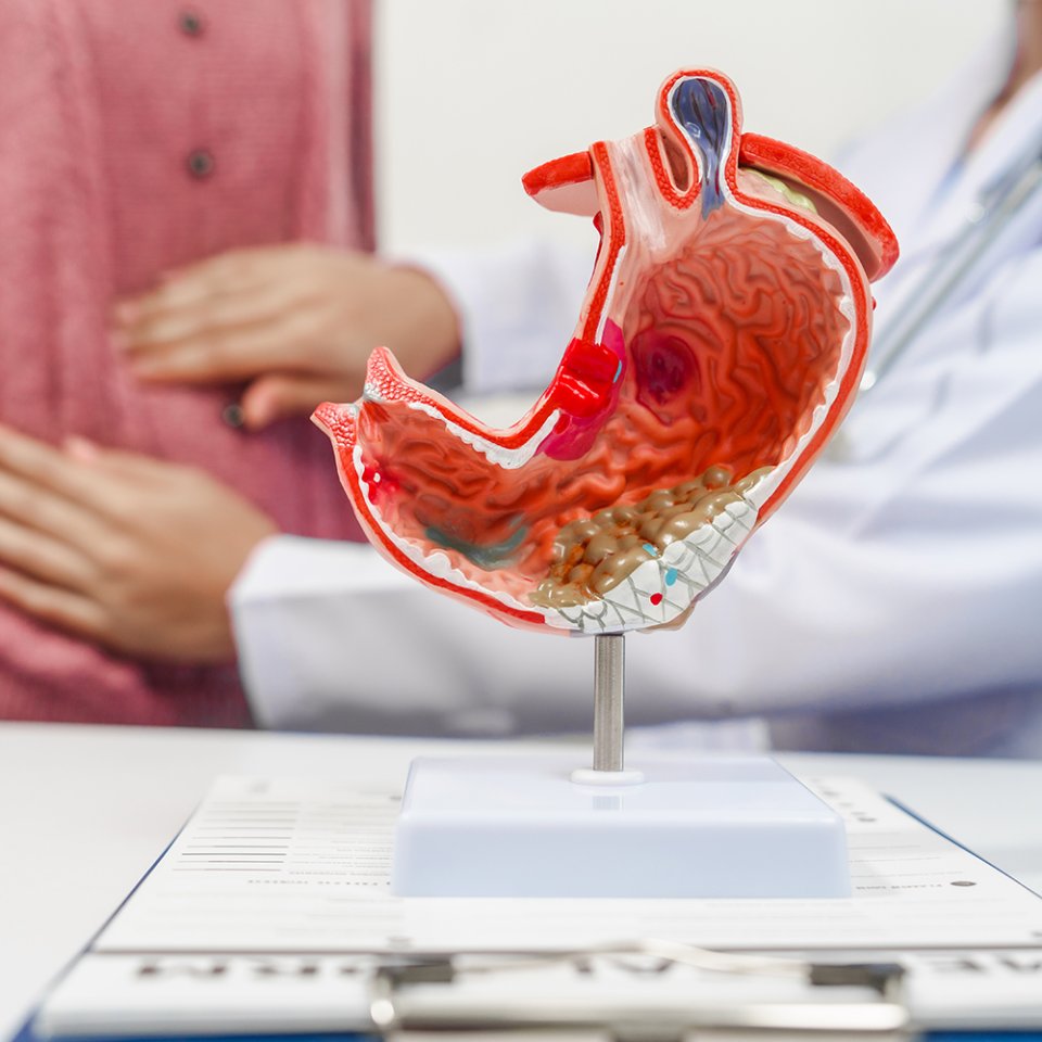 Why is Stomach Cancer Surgery Needed?